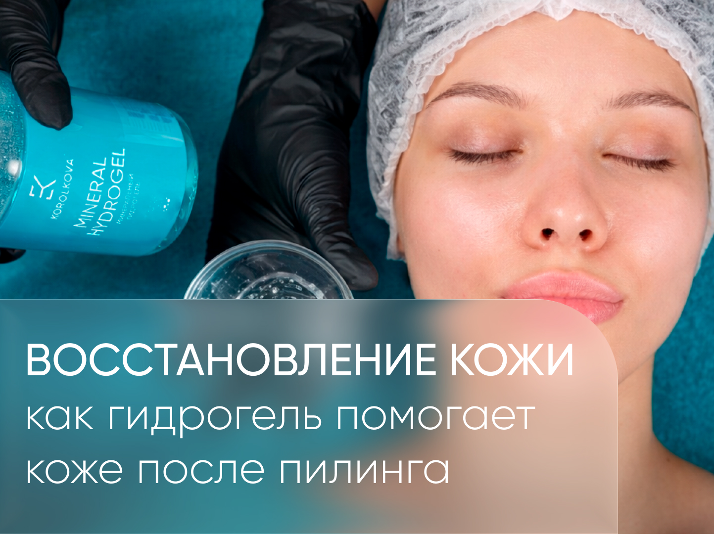после пилинга